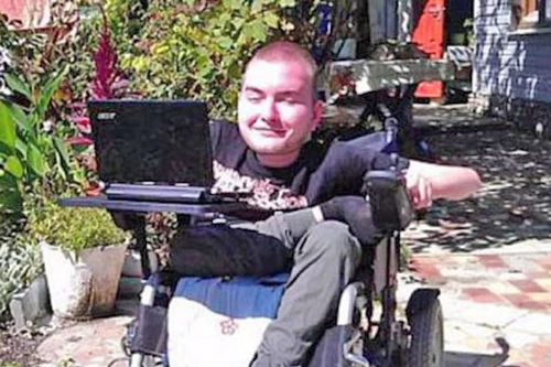 Người đầu tiên tình nguyện ghép đầu