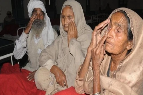 Phẫu thuật đục thể tinh thể khiến 19 người nhiễm trùng mắt