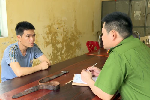 Bắt giam 'gã' chồng vũ phu hành hạ vợ đang mang thai với gần 70 vết bỏng trên khắp cơ thể