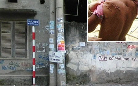 Hoảng loạn vì kẻ giấu mặt chuyên rạch lưng thiếu nữ