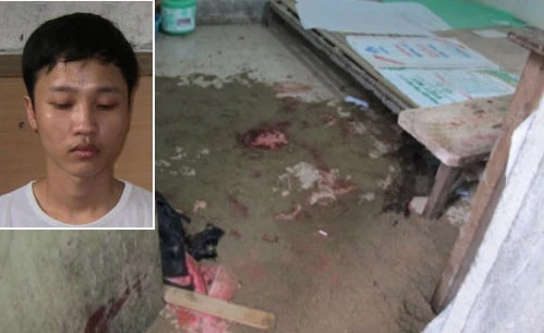 Giáp mặt tử tù 9X giết người yêu rồi tự sát bất thành