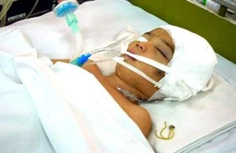 Chấn thương sọ não vì tai nạn hi hữu