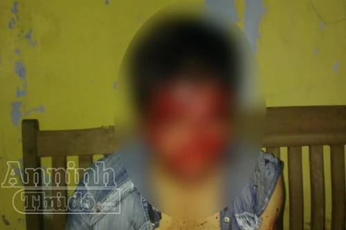 Mang súng giả đi đòi nợ, bị đánh suýt vong mạng