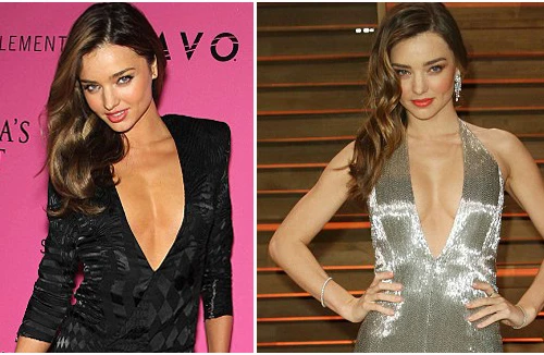 "Thiên thần nội y" bị dính nghi án nâng ngực