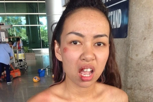 Điểm lại các vụ ca sĩ, diễn viên bị cướp giật