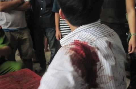 Côn đồ dùng súng bắn người giữa đường