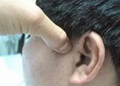 Đình chỉ một thầy lang chữa bệnh "vỗ tai", "bẻ lưỡi" kỳ quặc