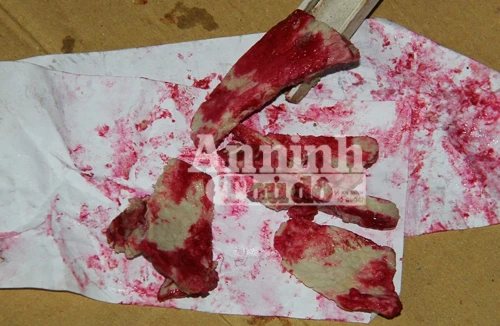 Thịt lợn chín chuyển màu đỏ do nhiễm khuẩn Serratia Marcescens