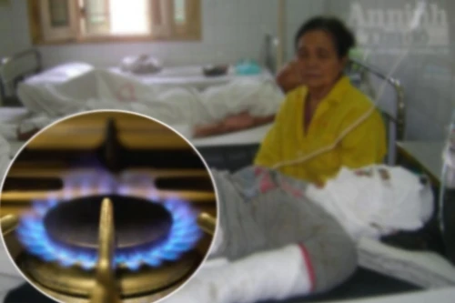 Cả gia đình bỏng nặng vì dây gas bị chuột gặm