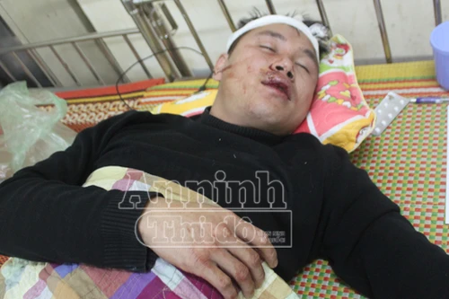 Giảng hòa cho nhóm sinh viên, chủ nhà trọ bị côn đồ hành hung dã man