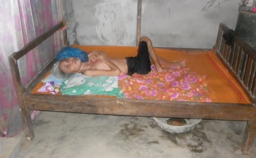 Xót lòng cụ bà bại não nằm liệt giường