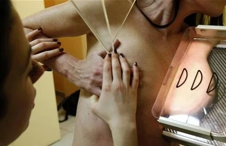 Hóa xạ trị đồng thời có lợi cho bệnh nhân ung thư vú