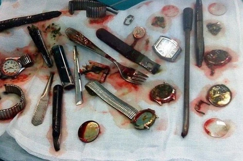 Nuốt cả mớ đồ ăn trộm để khỏi vào tù