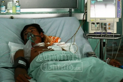 Ghen tuông, vợ đâm thủng tim chồng