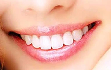 Cướp ngân hàng quốc gia để lấy tiền làm răng