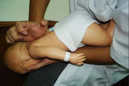 Bé 8 tháng tuổi bị tổn thương não do...sặc cháo