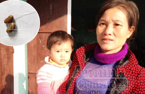 Hy hữu vụ cho trẻ uống nhầm vitamin A bằng... hạt đậu giống