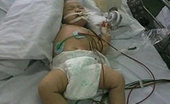 Bé 3 tháng tuổi nguy hiểm tính mạng vì ngộ độc thuốc nhỏ mũi