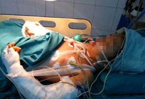 Bé Bích kể chuyện trốn kẻ thảm sát, cướp vàng