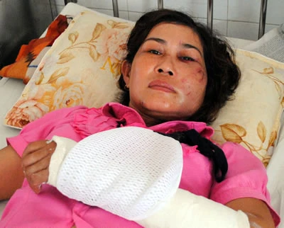 Xót xa một vụ bạo hành