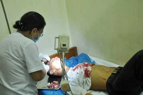 Phụ xe khách chém nhau vì tranh giành khách