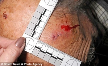 Nữ sinh thông đồng với mẹ giết ông để chiếm tài sản