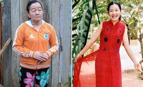 "Cô gái bà lão" vẫn có thể sinh con như thường