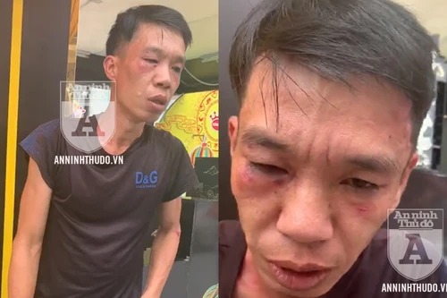 [CLIP] Cảnh sát 141 bắt tên cướp manh động