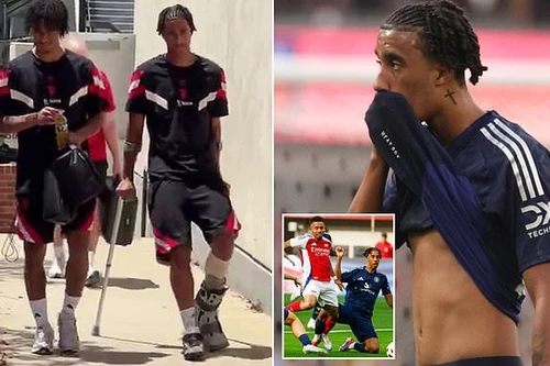 Vừa đến MU, trung vệ Leny Yoro đã phải chống nạng