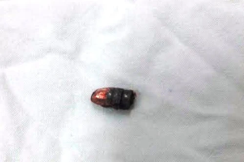 Súng bút nhặt được dưới suối lên phát nổ đạn ghim vào tay