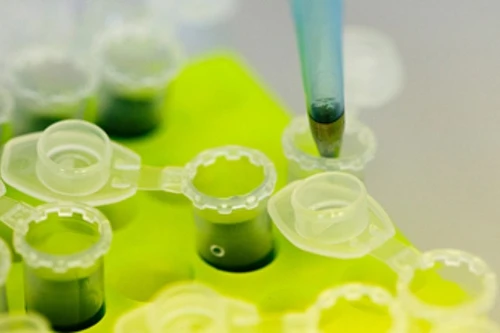 Phát hiện virus gây suy giảm nhận thức sống trong cổ họng người