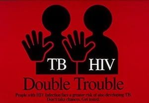 Dùng thuốc HIV sớm tăng tỉ lệ sống cho bệnh nhân lao/HIV
