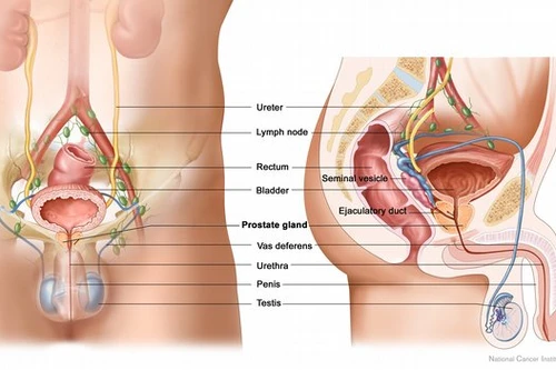 Xạ trị tăng sự sống cho bệnh nhân ung thư tuyến tiền liệt