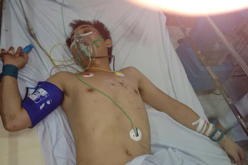 Đâm chết 2 người nhà vợ, rồi uống thuốc sâu tự tử...