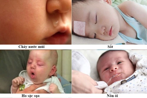 Số trẻ mắc ho gà ở Hà Nội tăng bất thường