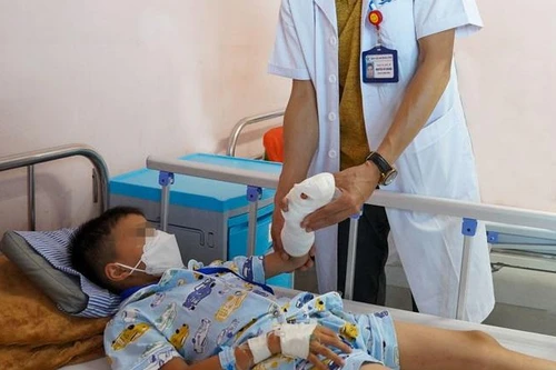 Phụ anh nấu cơm, bé trai 7 tuổi suýt đứt rời một ngón tay