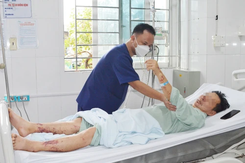 Người đàn ông nguy kịch do liên cầu khuẩn dù mua thịt lợn về nhà nấu ăn