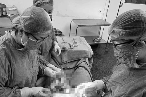 Hy hữu: Người phụ nữ ở Quảng Ninh mang thai đôi ở 2 tử cung khác nhau, 50 triệu ca mới gặp 1