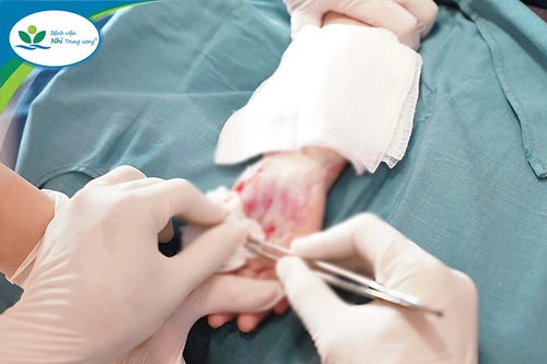 Liên tiếp 3 trẻ nhỏ bị bỏng nặng bàn tay do chạm vào máy chạy bộ khi máy đang vận hành