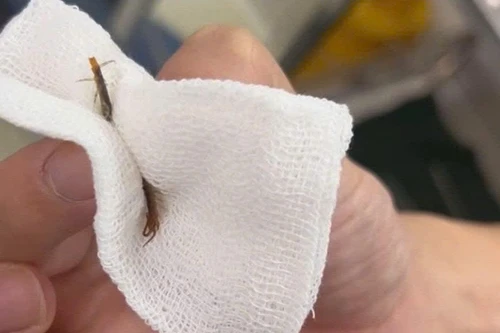 Ngủ ở công trường xây dựng, nam thanh niên bị con rết chui vào tai