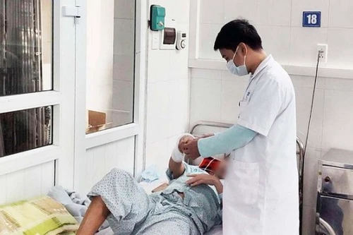 Hà Nội: Một tuần, 4 người bỏng nặng phải nhập viện do nướng mực bằng cồn