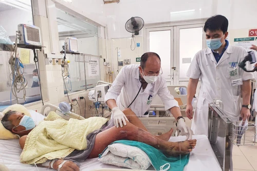 Người đàn ông bị hoại tử chân, nguy kịch do nhiễm một loại vi khuẩn sống ở vùng nước lợ