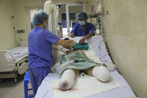 Hà Nội: Nạn nhân trong vụ nổ bình gas “như bom” ở Đông Anh phải cắt cụt hai cẳng chân