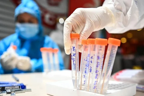 Hà Nội có một học viên Học viện Mật mã là F1 của ca dương tính SARS-CoV-2 ở Hà Nam