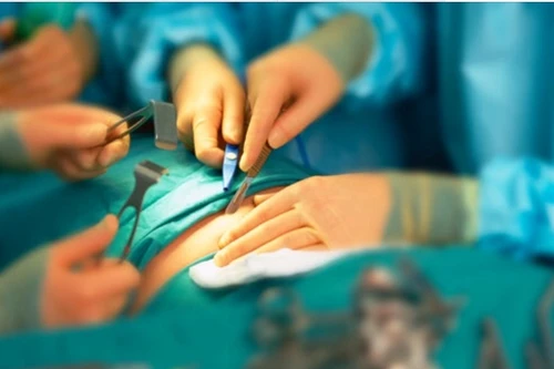 Thêm một trường hợp suýt mất dương vật do tai nạn trong sinh hoạt