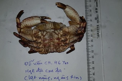 Một bệnh nhân nguy kịch, ngừng tim do ăn Cua mặt quỷ, tiên lượng dè dặt