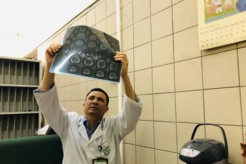 Nam thanh niên tử vong do uống quá nhiều rượu, bác sĩ cảnh báo về thuốc chống say