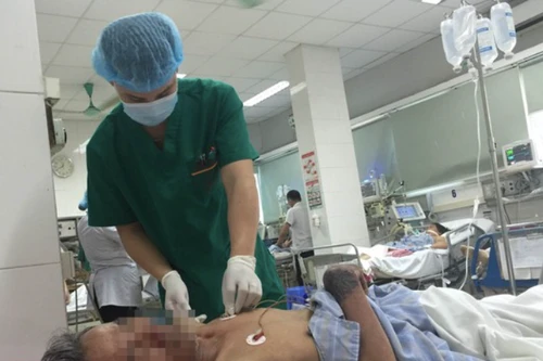 Hà Nội: Người đàn ông 48 tuổi nhập viện vì suy giảm nhận thức sau ăn tiết canh