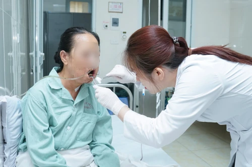 Đau miệng lâu ngày không khỏi, đi khám phát hiện ung thư lưỡi giai đoạn muộn