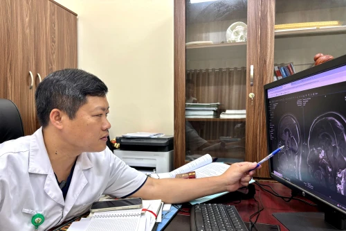 Ca phẫu thuật hiếm gặp tại Bệnh viện Việt Đức, cùng lúc mổ sọ và nội soi đường mũi